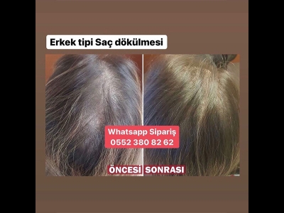 Kim Ne Diyor?