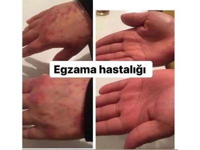 Kim Ne Diyor?