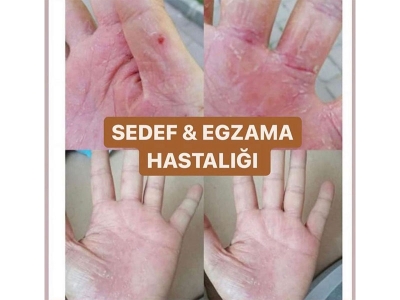 Kim Ne Diyor?