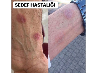 Kim Ne Diyor?